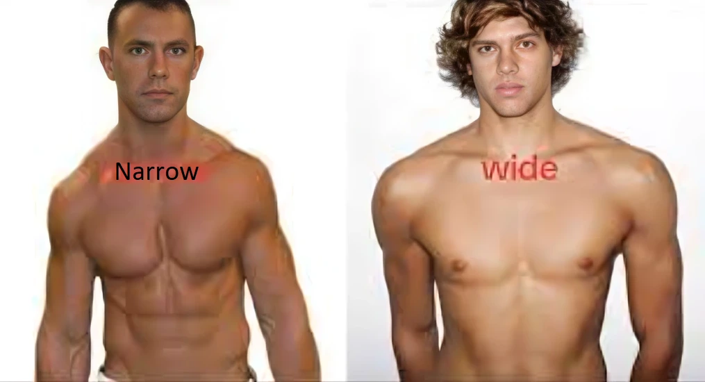 Narrow clavicles